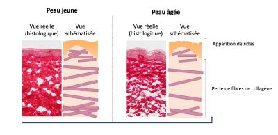 Collagene dans la peau selon l'age