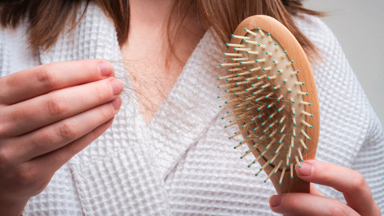 Chute de cheveux : traitement efficace