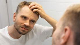 Alopécie chez les hommes : les causes possibles