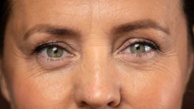 Toutes les rides du visage