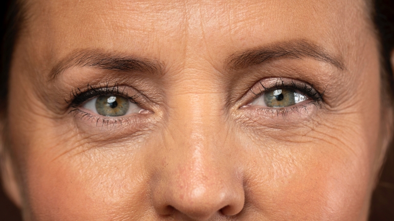 Les rides du visage